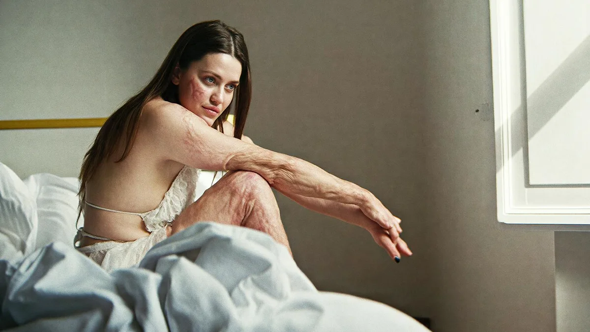 “More Than Skin Deep” : une célébration du corps dans toute sa diversité